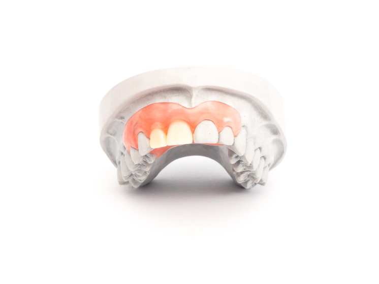 Pauli Zahntechnik Allergiefreie Kunststoffe Pauli Zahntechnik Allergiefreie Kunststoffe